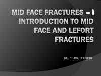 midfacefractures-18-140214005827-phpapp01.pdf